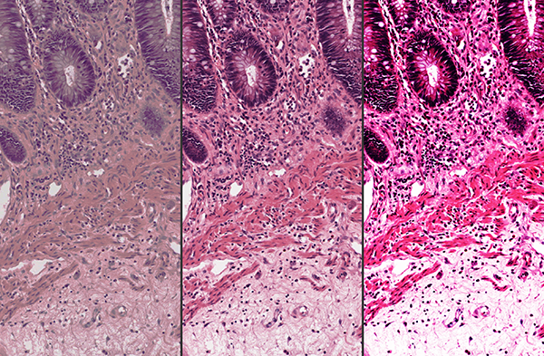 Example of image contrast